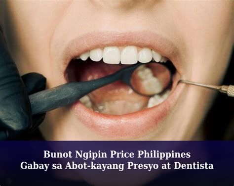 Dentista Murang bunot ng ngipin .